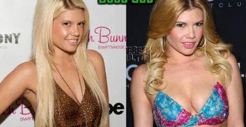 Chanel West Coast Boob Job, Plastic Surgery Before After - C