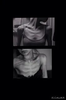 Extreme thinspo/bonespo- collarbones - Imgur