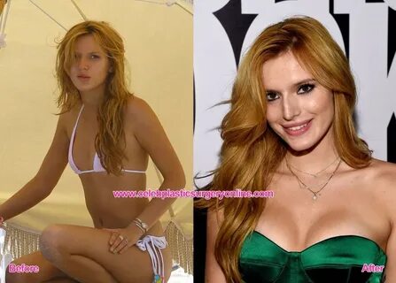 Bella Thorne before and after breasts augmentation Celebrity