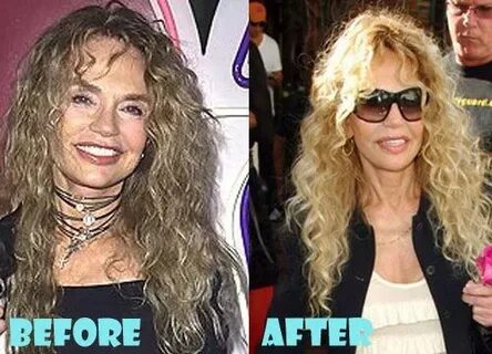 Dyan Cannon Plastic Surgery Before and After Pictures Celeb 