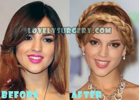 Eiza Gonzalez Plastic Surgery Before and After Photos - Love
