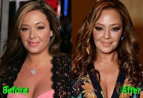 Leah Remini Plastic Surgery: Forever Young Leah