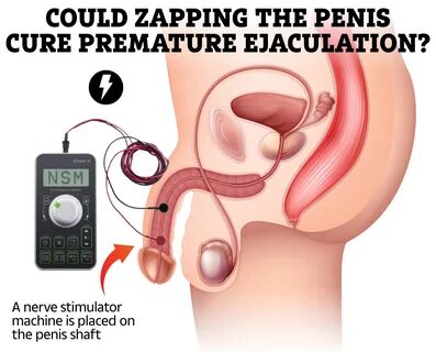 Ejaculation machine