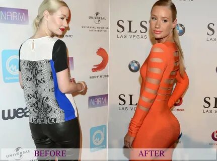 During all her life Iggy Azalea wanted to have much bigger boobs