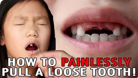 How To Pull Your Tooth Out Quickly " New Ideas