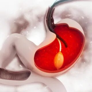 How Long Does Gastric Balloon Application Take? 