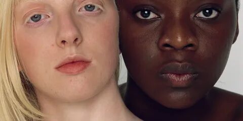 Intakt Menschlich Krug can only black people be albino Mante