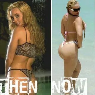 5 Celebs Whose Plastic Surgery Went Wrong Slide 5, ifairer.c