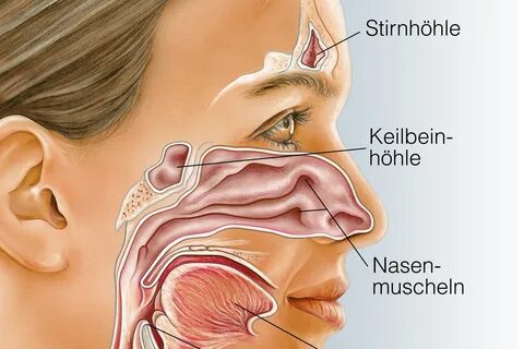 Nasennebenhöhlenentzündung Symptome Ohne Schnupfen - Caption