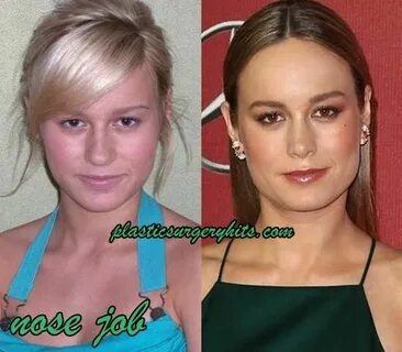 Brie Larson Plastic Surgery Before and After Nose job, Plast