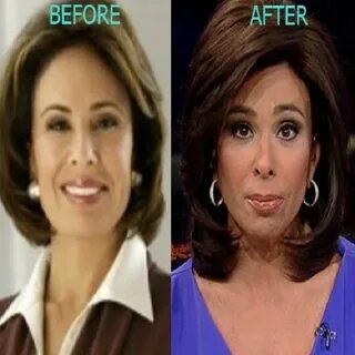 Jeanine Pirro Plastic Surgery Before and After Pictures - Br