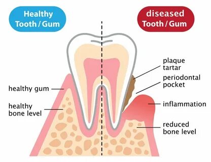 Periodontist cumming ga