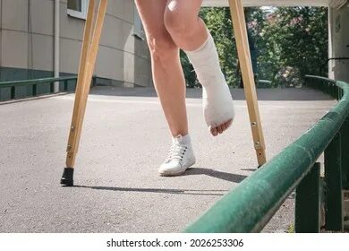 Eine Frau mit gebrochenem Bein geht Stockfoto 2026253306 Shu