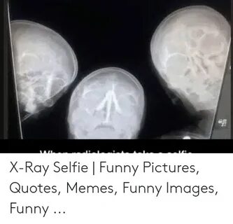 Funny Xray Meme - Elspeth Bright