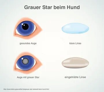 Grauer Star Symptome Erkennen - Quotes Resume