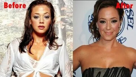 Leah Remini Plastic Surgery Before and After Plastic surgery