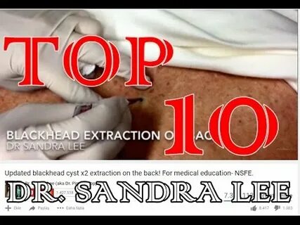 Dr. Sandra Lee (aka Dr. Pimple Popper) Top 10 Popular Videos
