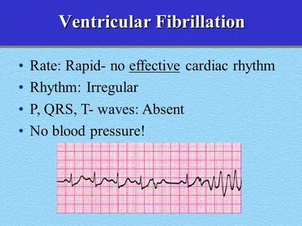 Advanced Cardiac Life Support - ppt video online download