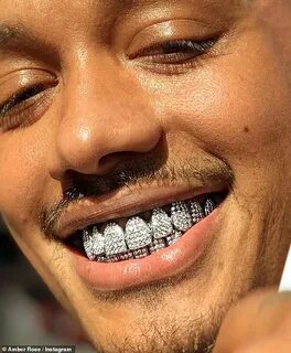 независим академия самоубийство permanent grills for teeth к