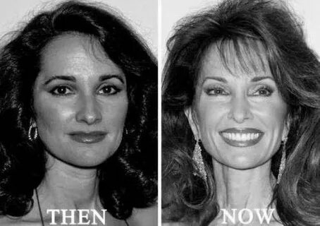 Plastic Surgery Photos - SkillOfKing.Com