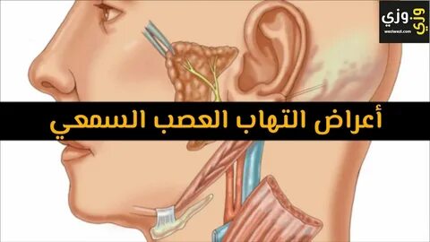 أهم أعراض التهاب العصب السمعي - YouTube