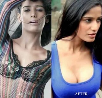 Plastic Surgery in Bollywood.