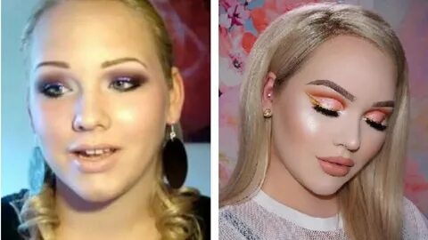 Nikkie De Jager Before Plastic Surgery : Before & After Plas