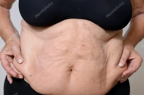 Cerca de media edad mujer sostiene su vientre graso - Fotos 