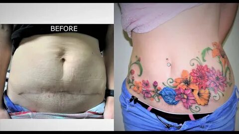 Pregnancy Stretch Mark Tattoo Cover Up - Tricheenlight