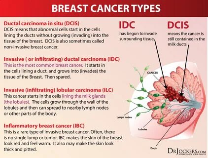 Breast Cancer: Causes, Symptoms and Natural Support Strategi
