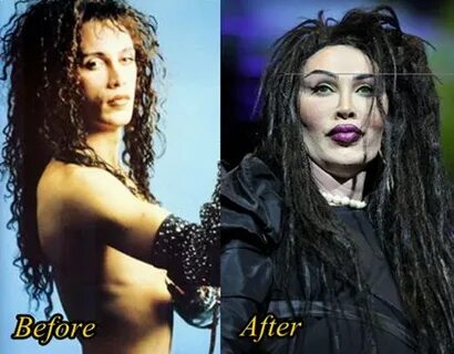 Pete Burns Plastic Surgery Gone Wrong Before and After - Pla