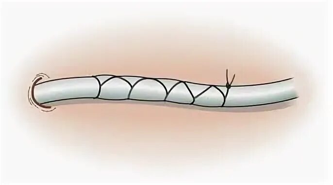 Suture Techniques Used in Veterinary Surgery - Boz Medical