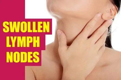 Home Remedies for Swollen Lymph Nodes Top 10 Home Remedies S
