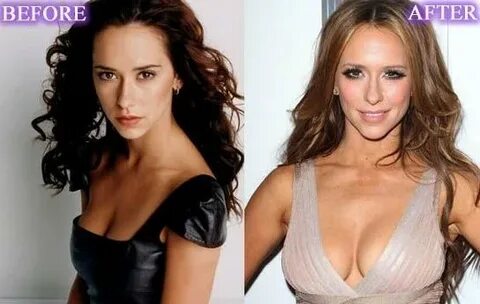 Jennifer Love Hewitt before and after breast implants Celebr