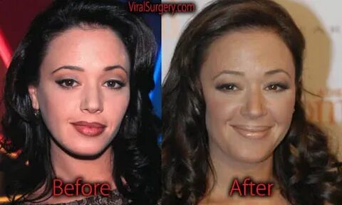 Leah Remini Plastic Surgery: Before and After Botox, Boob Jo