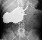 31 Funny X-Ray Images That Seem Too Ridiculous To Be Real
