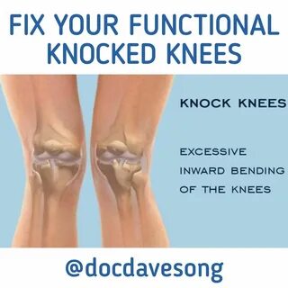 Dr. David Paul Song on Instagram: "▶ ️◀ FIX YOUR FUNCTIONAL K