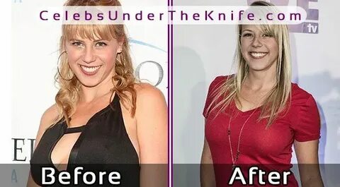 Jodie Sweetin's Boob Job? Before + After Photos Of Her Plast