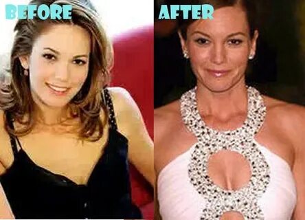 Diane Lane Plastic Surgery Before and After Photos - Lovely 