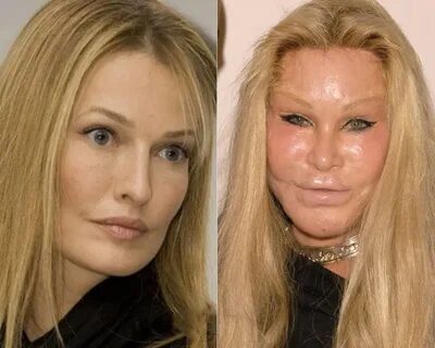 Celebrities who looked better before plastic operations.