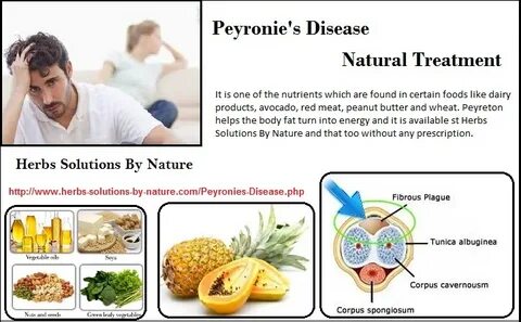 Some of the Natural Ways Treat Peyronie's Disease - Herbs So