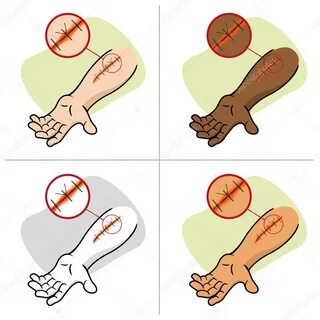 Illustration of a receiving first aid, injury or cut and sut