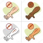 Illustration of a receiving first aid, injury or cut and sut