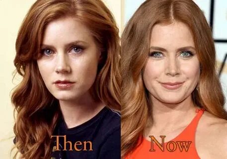 Amy Adams Plastic Surgery, Before and After Nose Job Picture