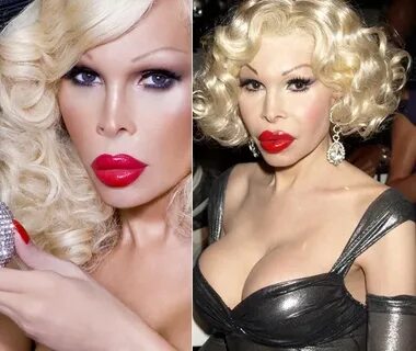 Amanda Lepore Before And After Plastic Surgery Pictures