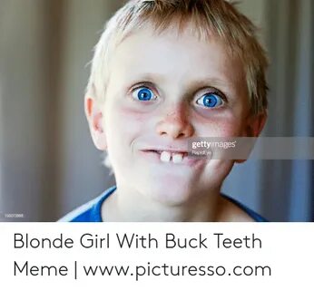 Buck teeth photos Tully Smyth shares photos of her 'buck tee