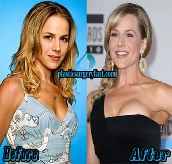Julie Benz Plastic Surgery Before and After - Plastic Surger