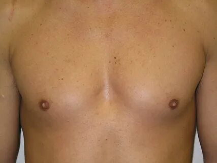 Male nipples female 