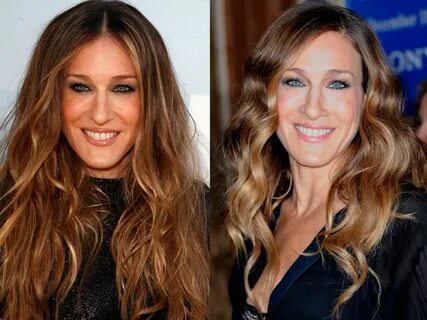 Sarah Jessica Parker plastic surgery procedures In 2017 - De