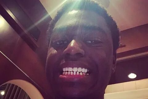 Kodak Black Gets Permanent Gold Teeth Removed - XXL